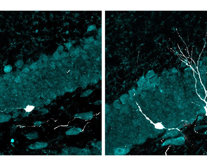 Estudio preclínico: la estimulación con luz y sonido intermitentes promueve el desarrollo de nuevas neuronas en cerebros envejecidos