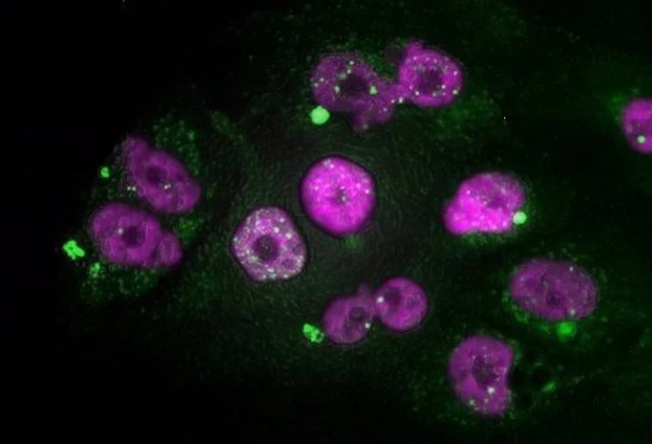 Nuevas pruebas para detectar cáncer de forma temprana