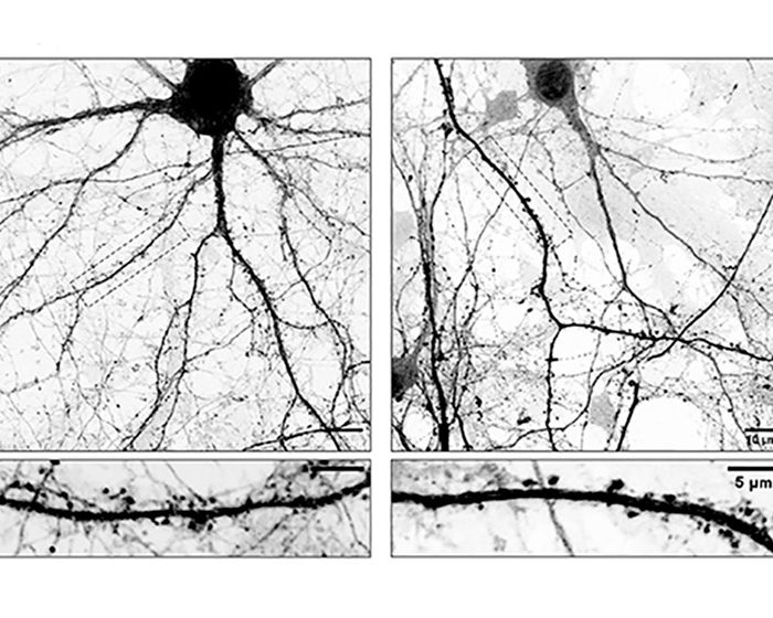 Develan mecanismos que podrían abrir un camino hacia la optimización de las terapias contra el Parkinson
