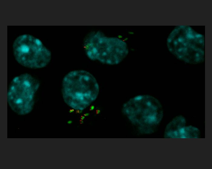 Descubren una estrategia energética de la bacteria de la brucelosis para optimizar su multiplicación
