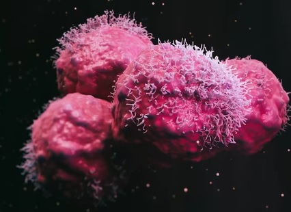 Pequeños cambios cotidianos que reducen el riesgo de cáncer Pequeños cambios cotidianos que reducen el riesgo de cáncer