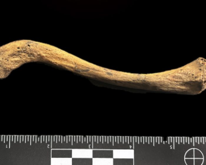Evidencia más antigua del mundo de la acción de una bacteria responsable de múltiples enfermedades