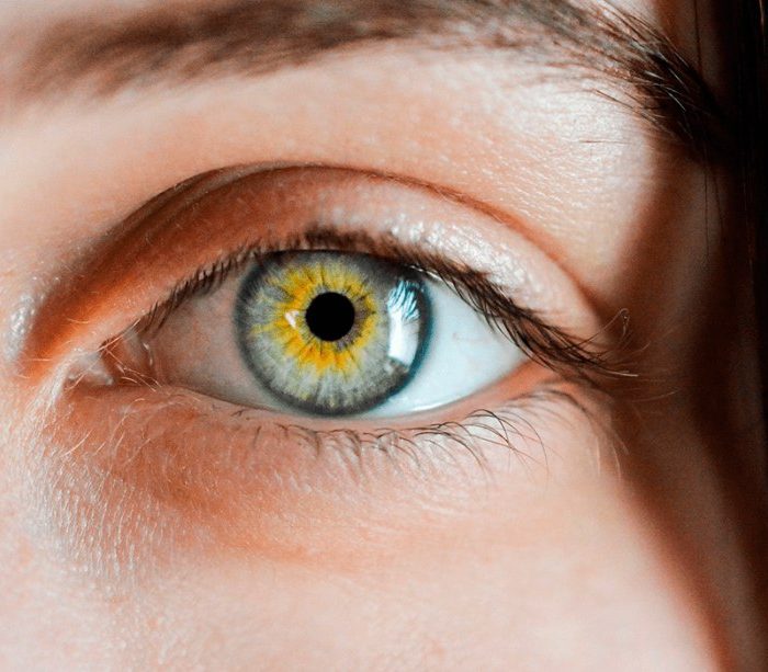 Glaucoma: es la primera causa de ceguera irreversible y el 50% de las personas no sabe que lo tiene