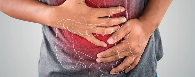 La enfermedad autoinmune que afecta al intestino y suele confundirse con colon irritable