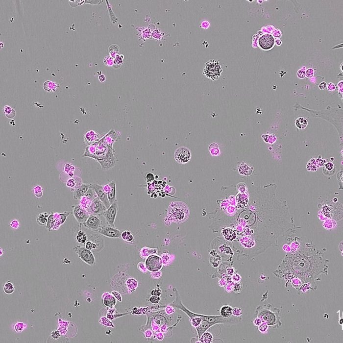 Un nuevo CRISPR actúa como ‘interruptor letal’ que destruye el ADN de células enfermas