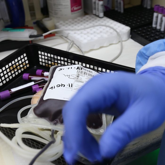 7.000 a 8.000 nuevos pacientes de diálisis por año en Argentina
