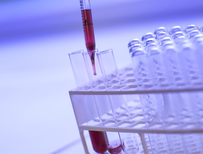 Biomarcadores que permiten diferenciar 4 enfermedades neurodegenerativas