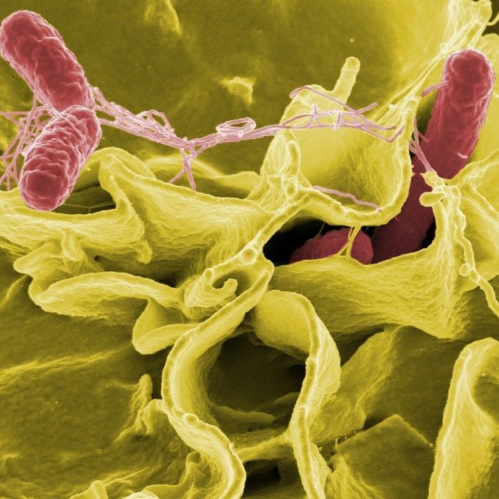 Científicos prueban un método con IA para tratar superbacterias resistentes a antibióticos