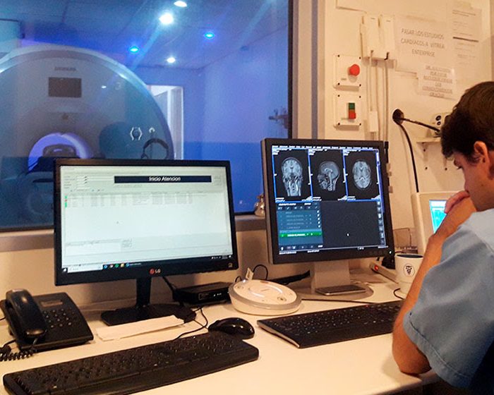 Más allá de la vigilia: científicos del CONICET estudian qué ocurre en el cerebro durante los estados no ordinarios de la conciencia